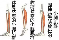 钙铁锌硒检测仪厂家经常腿抽筋不仅是缺钙还可能有这些原因你了解吗？
