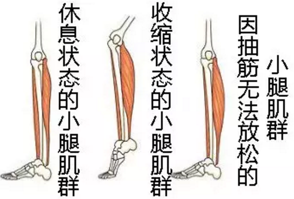 钙铁锌硒检测仪厂家经常腿抽筋不仅是缺钙还可能有这些原因你了解吗？